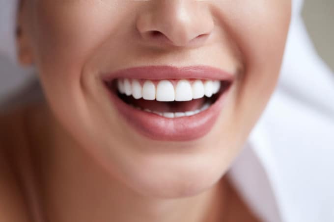 closeup of lady smiling for dental exam