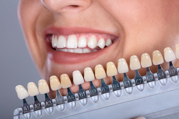 white teeth color selector with lady looking at the dental model teeth